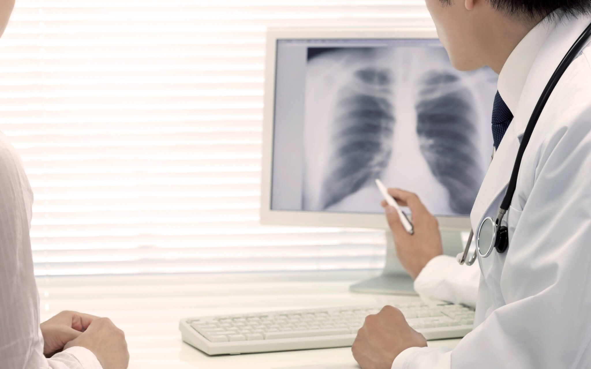 Mesothelioma doctor points towards their patients x-ray.