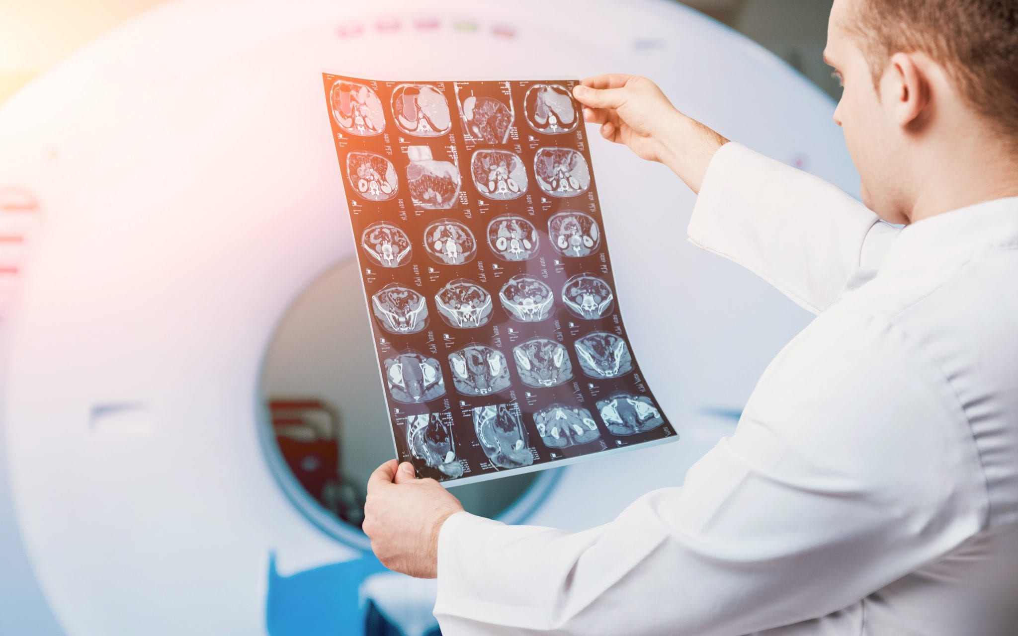 Doctor looking over mesothelioma tomography test results.