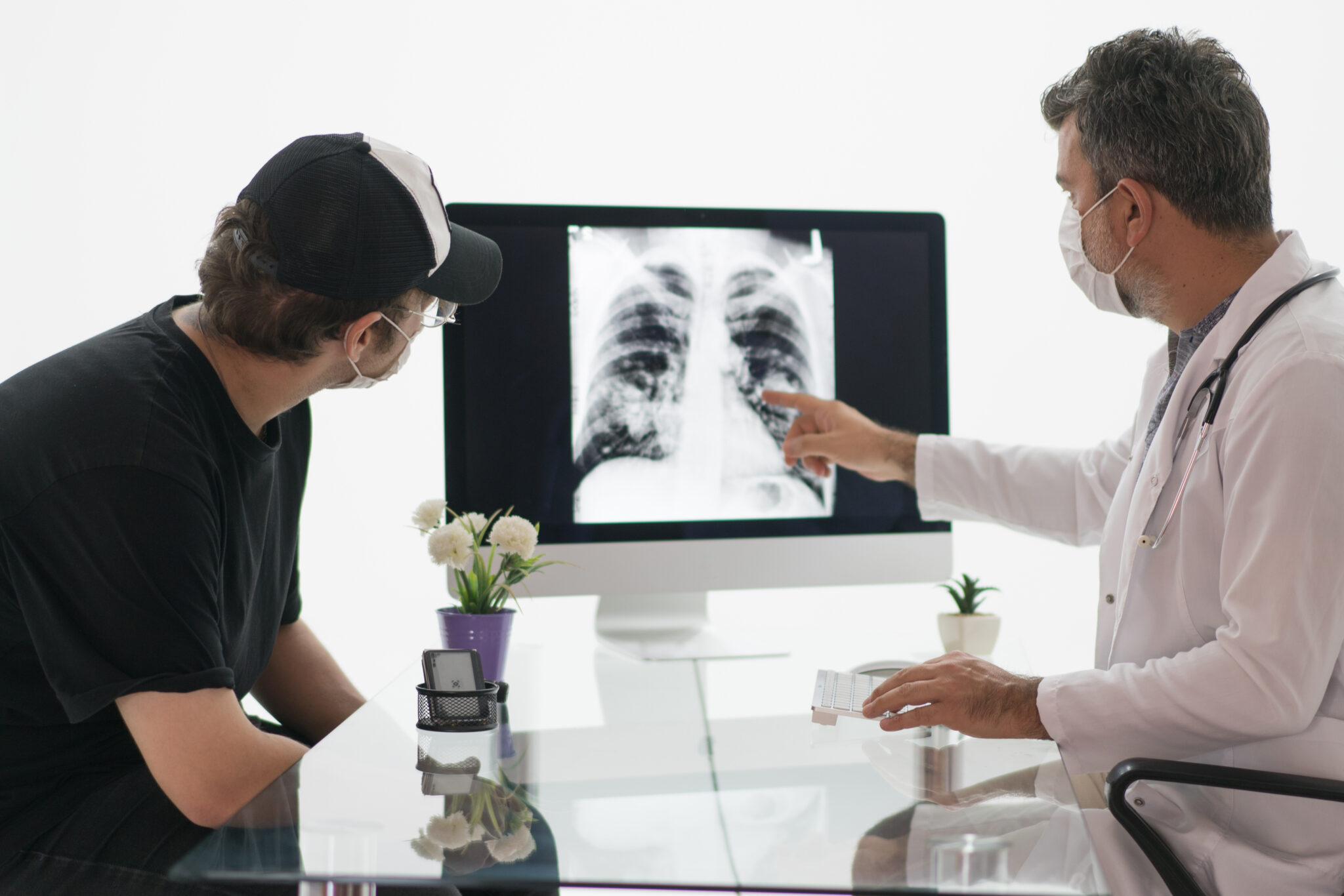 Doctor point at a mesothelioma tumor on an x-ray image.