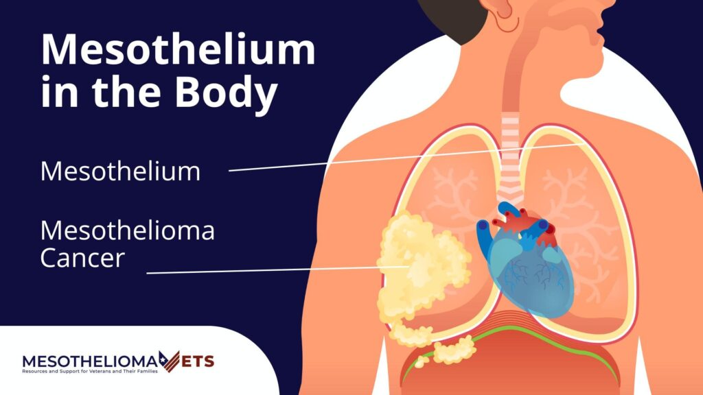 Infographic showing the mesothelium, the lining of the lungs, and mesothelioma cancer.